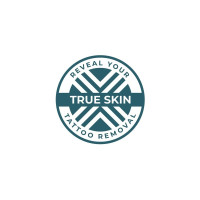 True Skin Tattoo Removal