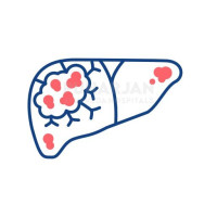 Best Liver Cancer Treatment Hospitals in Hyderabad