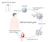 فهم قصص نجاح علاج الخلايا التائية CAR T في الكويت