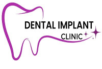 Affordable Dental Implants Phoenix