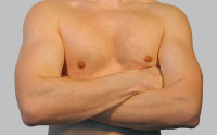 Gynecomastia Surgery in Riyadh
