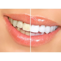 The ToothBooth