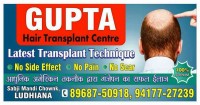 Gupta Hair Transplant in Ludhiana