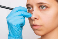 Rhinoplasty cost in Riyadh