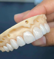 Dental lab in Shenzhen Dental manufacturer