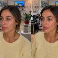 Perfect Aesthetics & Spa