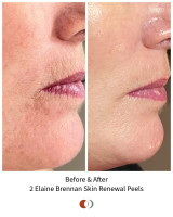 Dyad Skin and Wellness