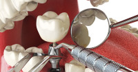 Dr. Malhotra's Super Speciality Dental Centre
