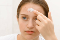 Acne Treatment in Riyadh