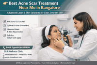 Best Acne Scar Treatment Near Me in Bangalore