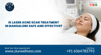 Best Acne Scar Treatment Near Me in Bangalore