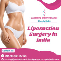 Best package for Liposuction surgery In India
