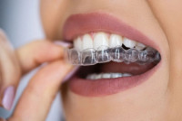 Shree Dental Clinic