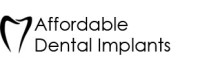 Affordable Dental Implants