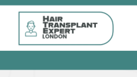 Hair Transplant Expert London