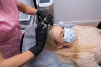 Hair Loss Treatment Companies