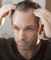 Hair Transplant in Riyadh
