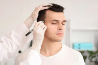 Best hair transplant treatment in islamabad