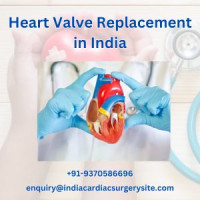 Best Price for Heart Valve Replacement India