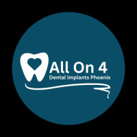 All on 4 Dental Implants Phoenix