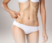 Liposuction in Riyadh