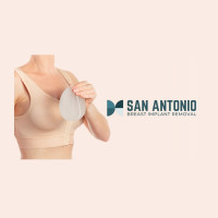 San Antonio Breast Implant Removal