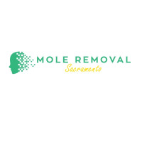 Mole Removal Sacramento