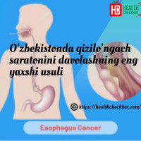 O'zbekistonda qizilo'ngach saratonini davolashning eng yaxshi u