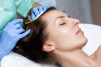 PRP Hair Treatment in Riyadh