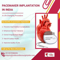 Pacemaker Implantation Cost India