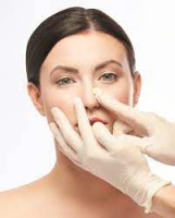 Rhinoplasty Surgery in Riyadh