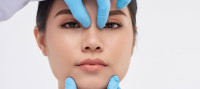 Rhinoplasty in Riyadh