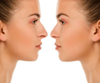 Rhinoplasty Surgery in Riyadh