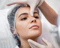 Rhinoplasty in Riyadh