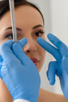 Rhinoplasty in Riyadh