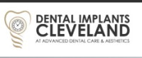 Restore Your Smile with Advanced Dental Implants For Missing Teeth Cleveland