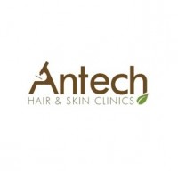Antech Hair Clinic