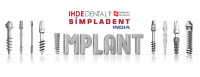 Dental Implant