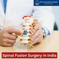 Spinal Fusion Surgery cost india