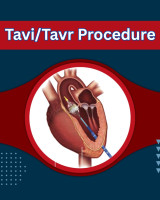 TAVR surgery cost in India