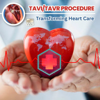 Tavi Tavr Procedure In India