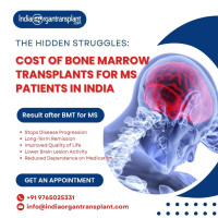 Cost of Bone Marrow Transplant for MS India