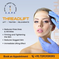 Thread Lift Surgery in Delhi