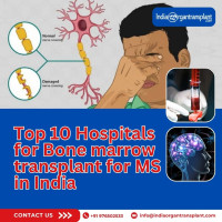 Bone Marrow Transplant for Multiple Sclerosis India