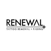 Renewal Tattoo Removal & Fading