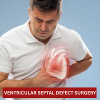 Low Cost Ventricular Septal Defect Surgery India