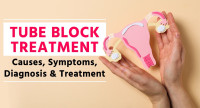 Tube Block Treatment | Blockage of Fallopian Tubes Treatment | Fallopian Tube Blockage Symptoms