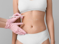 laser liposuction in Riyadh