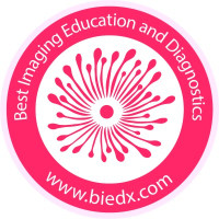 BIEDX