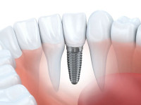 NuSmiles Dental